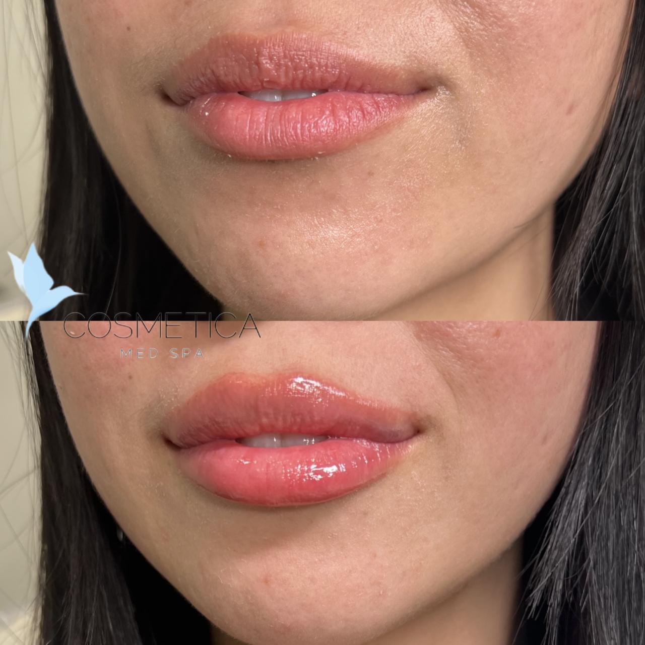 Gallery - Cosmetica Med Spa