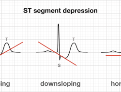 st barth beach bag Stylish and Functional for All Occasions